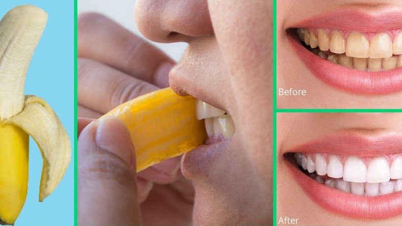 How to whiten the teeth using banana peels